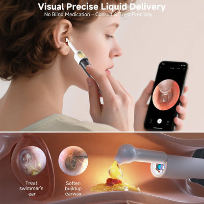 Rechargeable Smart Wireless Ear Camera Kit | Visual Ear Wax Removal Tool | Random Colour